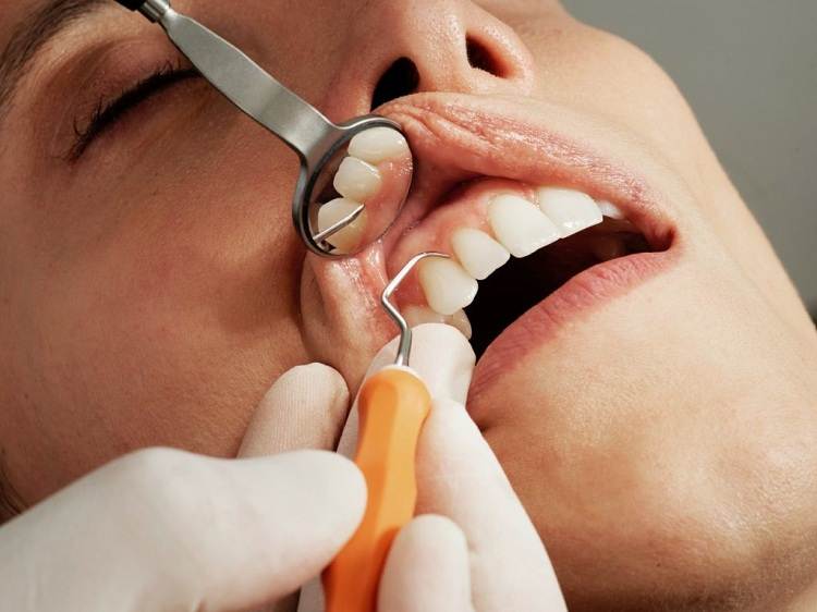 آماده سازی برای جراحی لثه
