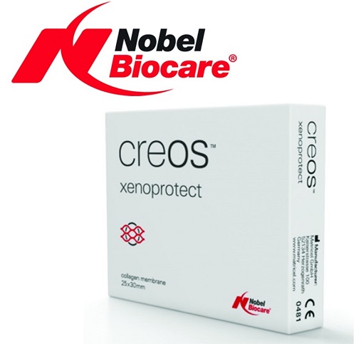برند ایمپلنت دندانی Nobel biocare
