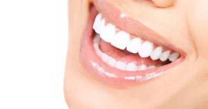 روش های طراحی لبخند