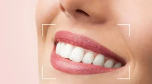عوامل تاثیرگذار در طراحی لبخند