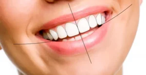 طراحی لبخند