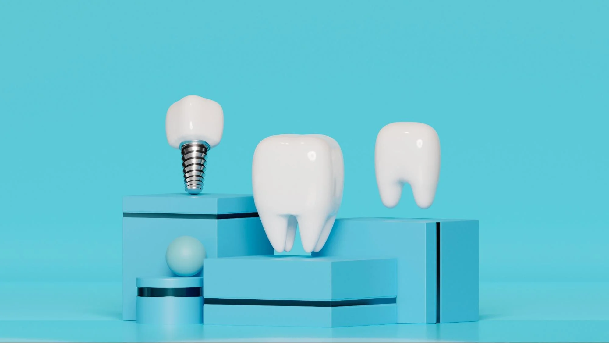 مراقبت های بعد از ایمپلنت دندان 1 Post implant care